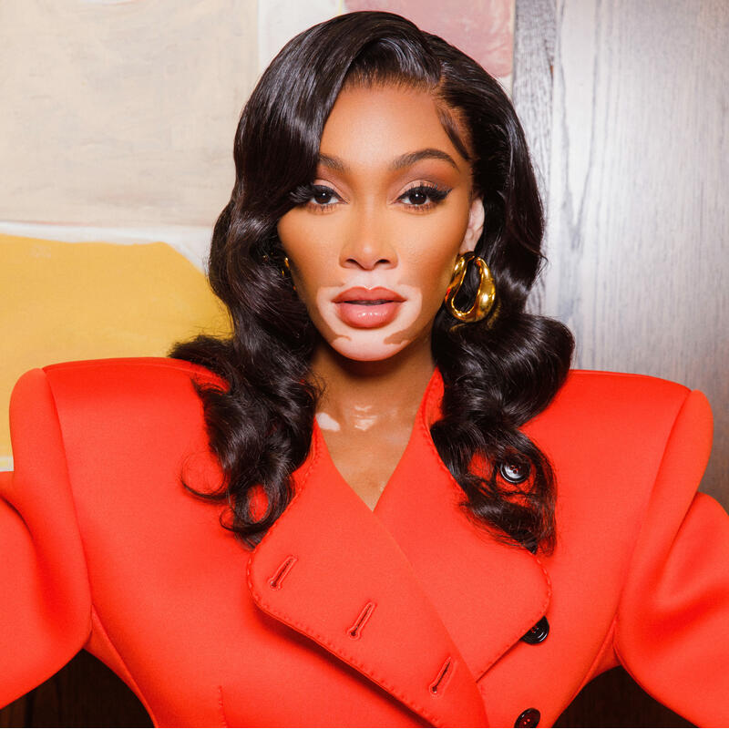 A person with vitiligo wearing a vibrant red double-breasted blazer with structured shoulders, adorned with gold jewelry, poses confidently indoors, against a wooden and abstract art background.